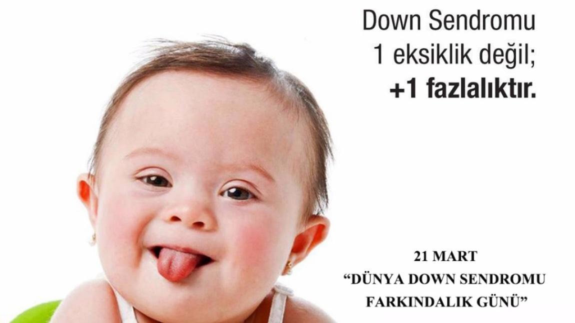 21 Mart Dünya Down Sendromu ve Farklılık Günü Kutlu Olsun!